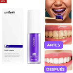 Blanqueador Dental V34 - Tecnología de Salón en Casa