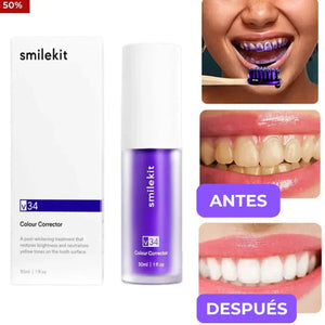 Blanqueador Dental V34 - Tecnología de Salón en Casa